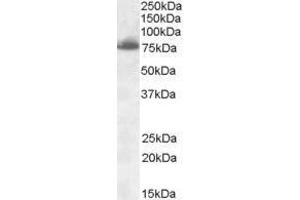 Western Blotting (WB) image for anti-delta-Like 1 (DLL1) (Internal Region) antibody (ABIN2473310) (DLL1 antibody  (Internal Region))