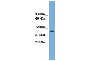 WB Suggested Anti-SPRY4 Antibody Titration:  0. (SPRY4 antibody  (Middle Region))