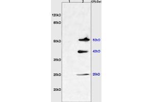 L1 mouse liver lysates L2 mouse brain lysates probed with Anti NGX6/C9orf127 Polyclonal Antibody, Unconjugated (ABIN737136) at 1:200 overnight at 4 °C. (TMEM8B antibody  (AA 21-120))