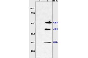 L1 mouse liver lysates L2 mouse brain lysates probed with Anti NGX6/C9orf127 Polyclonal Antibody, Unconjugated (ABIN737136) at 1:200 overnight at 4 °C.