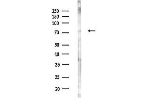 anti-NADH Dehydrogenase (Ubiquinone) Fe-S Protein 1, 75kDa (NADH-Coenzyme Q Reductase) (NDUFS1) (N-Term) antibody