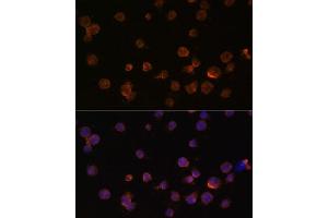 Immunofluorescence analysis of THP-1 cells using CTGF antibody (ABIN6127716, ABIN6139187, ABIN6139190 and ABIN6215053) at dilution of 1:100. (CTGF antibody  (AA 27-349))