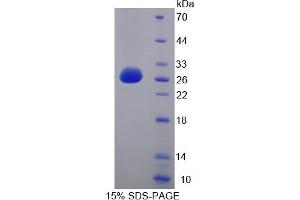 Image no. 1 for Huntingtin Associated Protein 1 (HAP1) (AA 132-328) protein (His tag) (ABIN4990753) (HAP1 Protein (AA 132-328) (His tag))
