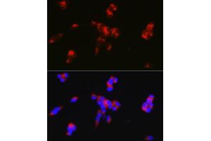 Immunofluorescence analysis of SH-SY5Y cells using D Rabbit pAb (ABIN6130242, ABIN6146067, ABIN6146068 and ABIN6219688) at dilution of 1:50 (40x lens). (DARPP32 antibody  (AA 1-168))