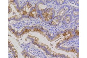 Paraformaldehyde-fixed, paraffin embedded Rat small intestine, Antigen retrieval by boiling in sodium citrate buffer (pH6) for 15min, Block endogenous peroxidase by 3% hydrogen peroxide for 30 minutes, Blocking buffer at 37°C for 20min, Antibody incubation with Cytokeratin 20 (1F10) Monoclonal Antibody  at 1:50 overnight at 4°C, followed by a conjugated secondary and DAB staining. (KRT20 antibody)
