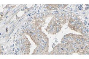 ABIN6279799 at 1/100 staining Human prostate tissue by IHC-P.