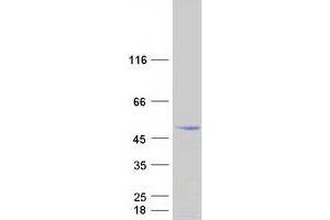 Chromosome 7 Open Reading Frame 25 (C7ORF25) (Transcript Variant 2) protein (Myc-DYKDDDDK Tag)