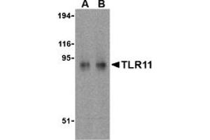 Image no. 2 for anti-Toll-Like Receptor 11 (Tlr11) (C-Term) antibody (ABIN204061)