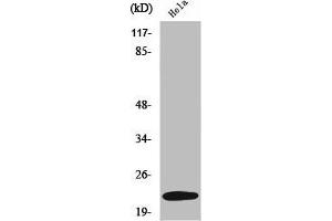 Western Blot analysis of K562 cells using UBE2T Polyclonal Antibody (Ube2t antibody  (Internal Region))