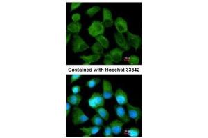 ICC/IF Image Immunofluorescence analysis of methanol-fixed A431, using TPP1, antibody at 1:200 dilution. (TPP1 antibody)