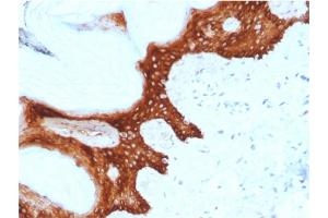 Formalin-fixed, paraffin-embedded human Skin stained with Stratifin Mouse Monoclonal Antibody (CPTC-SFN-2). (14-3-3 sigma/SFN antibody)