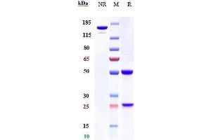 Anti-Complement C3 Reference Antibody (NGM621) on SDS-PAGE under reducing (R) condition.