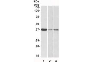 Western blot testing of human 1) liver, 2) skin and 3) tonsil lysate with IL12B antibody at 0. (IL12B antibody)
