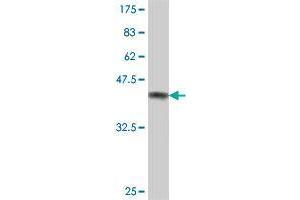 Western Blot detection against Immunogen (36. (FKBP10 antibody  (AA 377-470))