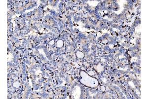 IHC analysis of EVL using anti-EVL antibody (ABIN7600986). (EVL antibody  (AA 268-400))