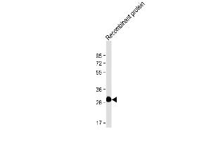 Anti-ROS1 Antibody at 1:4000 dilution + Recombinant protein Lysates/proteins at 20 ng per lane. (ROS1 antibody)