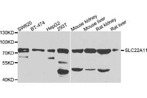Western blot analysis of extracts of various cells, using SLC22A11 antibody. (SLC22A11 antibody)