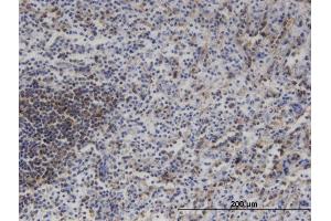 Immunostaining (ISt) image for anti-Mitogen-Activated Protein Kinase Kinase Kinase 11 (MAP3K11) (AA 741-847) antibody (ABIN517943)