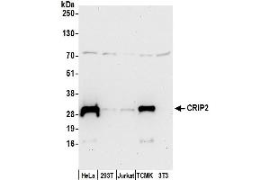 anti-Cysteine-Rich Protein 2 (CRIP2) (AA 158-208) antibody