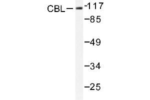 Image no. 1 for anti-Cas-Br-M (Murine) Ecotropic Retroviral Transforming Sequence (CBL) antibody (ABIN272004) (CBL antibody)
