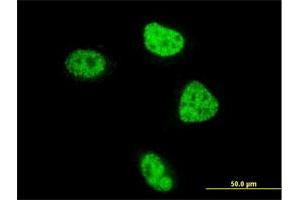 Immunofluorescence of monoclonal antibody to ZBTB33 on HeLa cell. (ZBTB33 antibody  (AA 564-673))