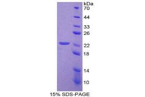 SDS-PAGE (SDS) image for Baculoviral IAP Repeat Containing 2 (BIRC2) (AA 148-298) protein (His tag) (ABIN1169928)