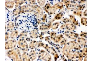 IHC testing of FFPE mouse kidney with HSC70 antibody.