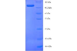 SDS-PAGE (SDS) image for GS Homeobox 1 (GSX1) (AA 1-518), (full length) protein (His-SUMO Tag) (ABIN5711105) (GSX1/GSH1 Protein (AA 1-518, full length) (His-SUMO Tag))