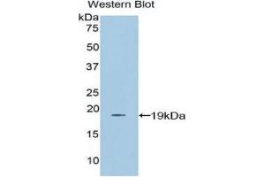 Western Blotting (WB) image for anti-Farnesyl-Diphosphate Farnesyltransferase 1 (FDFT1) (AA 269-417) antibody (ABIN3206188) (FDFT1 antibody  (AA 269-417))