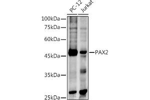 Western blot analysis of extracts of various cell lines, using P antibody (ABIN3017304, ABIN3017305, ABIN1681265 and ABIN6220029) at 1:500 dilution.