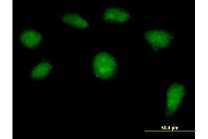 Immunofluorescence of purified MaxPab antibody to HSPC142 on HeLa cell. (BRISC and BRCA1 A Complex Member 1 (BABAM1) (AA 1-329) antibody)