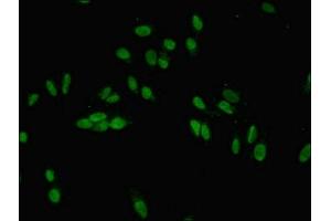 Immunofluorescent analysis of Hela cells using ABIN7165672 at dilution of 1:100 and Alexa Fluor 488-congugated AffiniPure Goat Anti-Rabbit IgG(H+L) (JARID2 antibody  (AA 1-159))