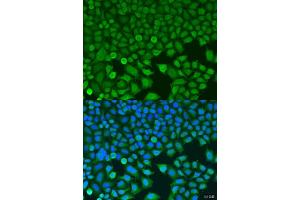 Immunofluorescence analysis of U2OS cells using BCKDK antibody (ABIN6127484, ABIN6137492, ABIN6137493 and ABIN6224210) at dilution of 1:100. (BCKDK antibody  (AA 153-412))