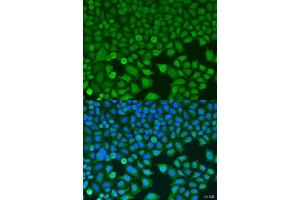 Immunofluorescence analysis of U2OS cells using BCKDK antibody (ABIN6127484, ABIN6137492, ABIN6137493 and ABIN6224210) at dilution of 1:100. (BCKDK antibody  (AA 153-412))