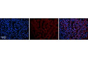 Rabbit Anti-TEAD4 Antibody    Formalin Fixed Paraffin Embedded Tissue: Human Adult liver  Observed Staining: Nuclear in endothelial cells not in hepatocytes Primary Antibody Concentration: 1:600 Secondary Antibody: Donkey anti-Rabbit-Cy2/3 Secondary Antibody Concentration: 1:200 Magnification: 20X Exposure Time: 0.