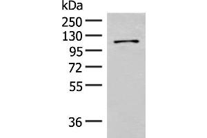Western blot analysis of Hela cell lysate using FANCB Polyclonal Antibody at dilution of 1:550 (FANCB antibody)