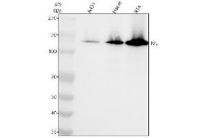 Western blot analysis of IVL using anti-IVL antibody (ABIN7605299).