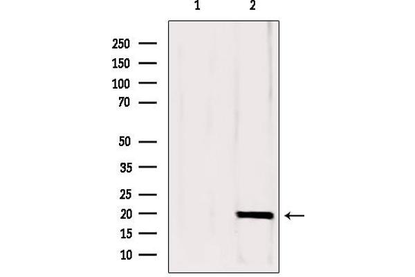 Complexin 1 antibody  (N-Term)