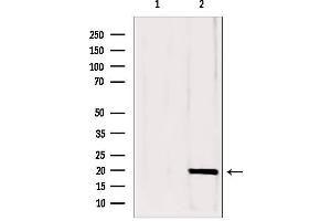 Western blot analysis of extracts from mouse brain, using CPLX1 antibody.