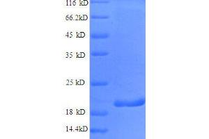 Interferon gamma (IFNG) (AA 24-162), (partial) protein (His tag) (Interferon gamma Protein (IFNG) (AA 24-161, partial) (His tag))