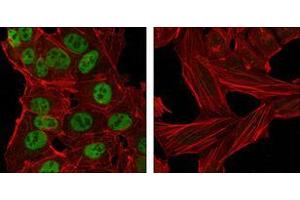 Confocal immunofluorescence analysis of NTERA-2 cells (left) and HeLa cells (right) using Nanog mouse mAb (green). (Nanog antibody  (AA 20-166))