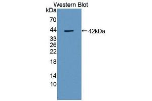 Western blot analysis of the recombinant protein. (CCL8 antibody  (AA 24-99))
