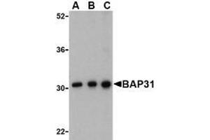 Western blot analysis of BAP31 in Ramos cell lysate with AP30123PU-N BAP31 antibody at (A) 0.