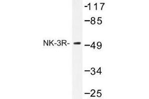 Image no. 1 for anti-Tachykinin Receptor 3 (TACR3) antibody (ABIN317708) (TACR3 antibody)