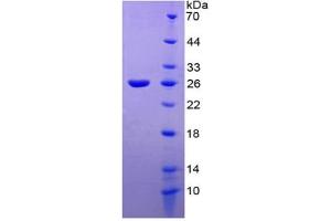 SDS-PAGE of Protein Standard from the Kit  (Highly purified E. (TIE1 ELISA Kit)