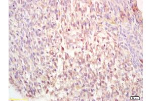 Formalin-fixed and paraffin embedded mouse embryo labeled with Rabbit Anti-ADORA2B Polyclonal Antibody, Unconjugated (ABIN1713360) at 1:200 followed by conjugation to the secondary antibody and DAB staining (Adenosine A2b Receptor antibody  (AA 251-300))
