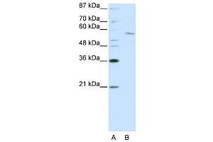 WB Suggested Anti-RCOR1  Antibody Titration: 0.