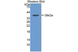Western blot analysis of the recombinant protein. (NCOA3 antibody  (AA 1-269))