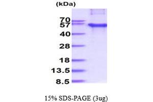 SDS-PAGE (SDS) image for Hydroxyacylglutathione Hydrolase (HAGH) (AA 1-260) protein (His tag) (ABIN667841) (HAGH Protein (AA 1-260) (His tag))