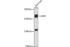 Western blot analysis of extracts of Rat brain, using EGFR antibody (ABIN6133681, ABIN6139977, ABIN6139982 and ABIN6219256) at 1:1000 dilution. (EGFR antibody  (AA 1100-1200))